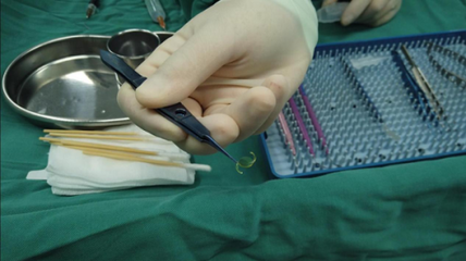 西宁爱尔完成西北地区首例散光三焦点人工晶体植入手术,帮助散光白内障人群实现“全程视力”